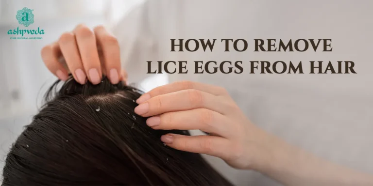 How To Get Rid Of Lice From Hair